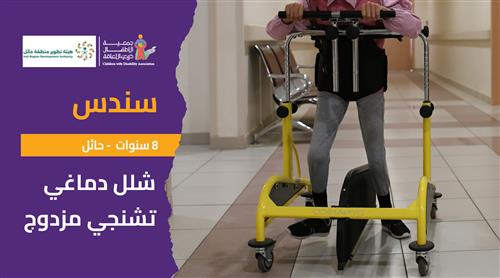 حلم سندس بدعم منسوبي هيئة تطوير منطقة حائل 