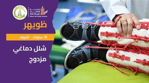 حلم ظويهر بدعم منسوبي أمانة منطقة الجوف