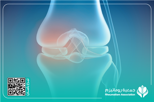 ورقة، احتياج لتدخل جراحي عاجل – عملية تغيير مفصل 