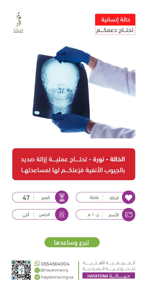 حالة إنسانية -الخالة نورة
