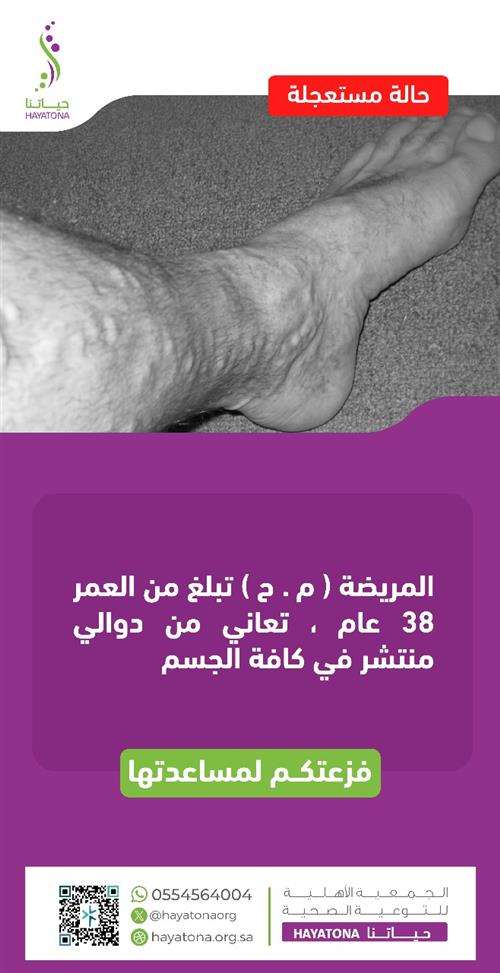 حالة عاجلة لمريضة تبلغ من العمر 38 عامًا