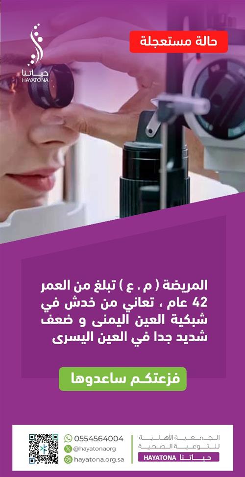 مريضة تبلغ 42 عامًا تعاني من خدش في الشبكية وضعف شديد