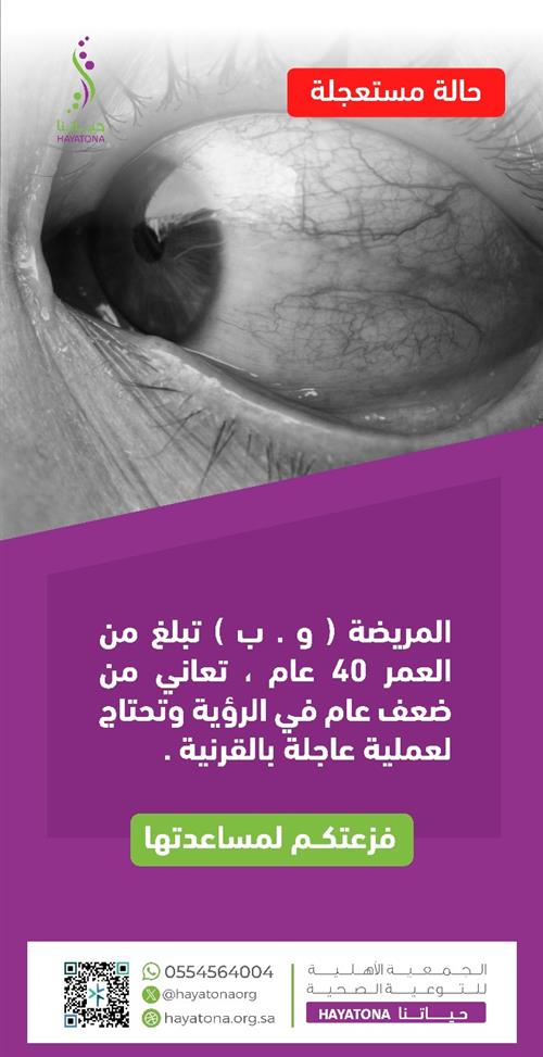  جراحة عاجلة لإزالة المياه البيضاء (القرنية) لمريضة تبلغ 40 عامًا