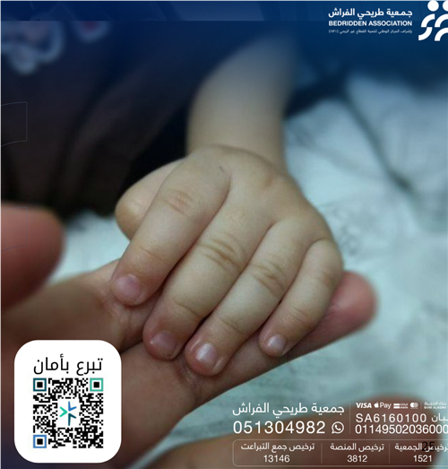 طفل يعاني من مشية غير طبيعية وفقدان شديد في التوازن