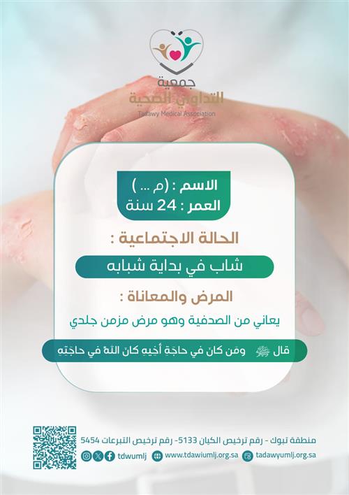 حالة عاجلة لشاب يعاني من الصدفية