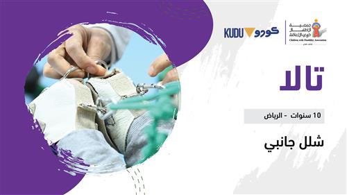 حلم تالا بدعم كودو