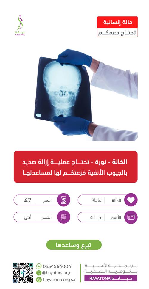 حالة إنسانية -الخالة نورة