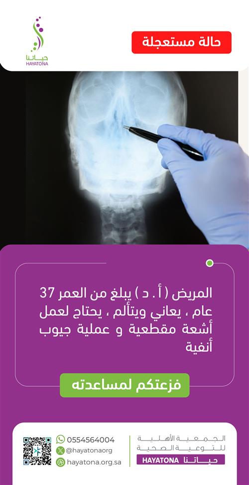 حالة إنسانية عاجلة – ساهم في تخفيف الألم