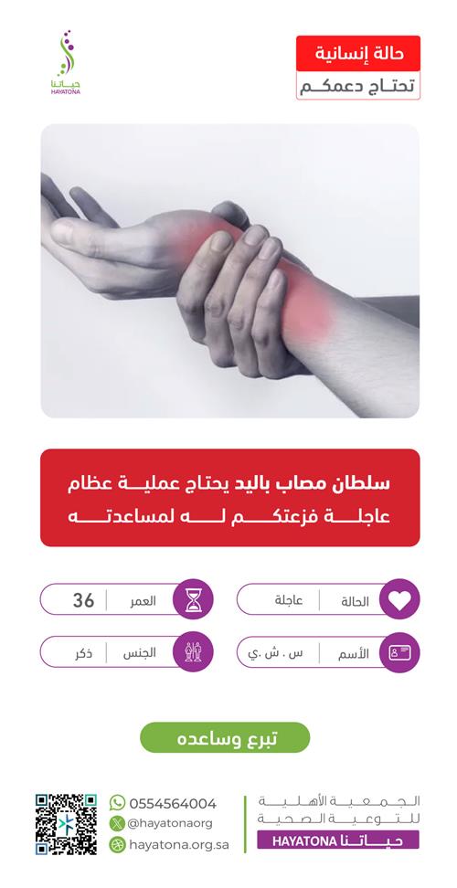 حالة إنسانية -سلطان يحتاج عملية باليد