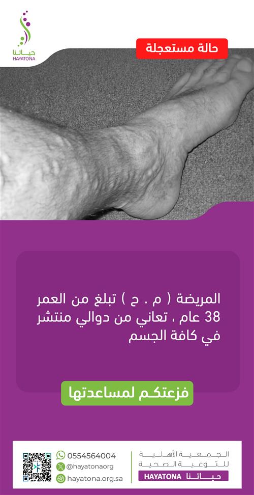 حالة عاجلة لمريضة تبلغ من العمر 38 عامًا