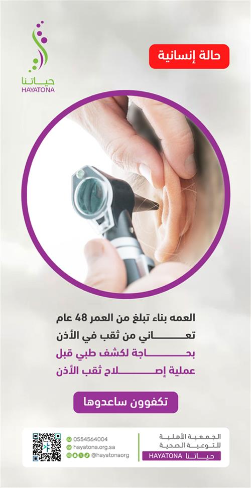 حالة عاجلة الخالة بناء 