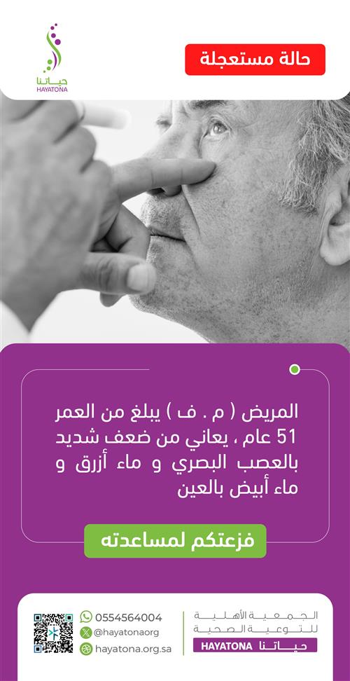 مريض يبلغ 51 عامًا يعاني من ضعف شديد في العصب البصري وماء أزرق 