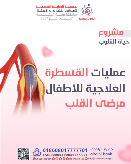 عمليات القسطرة العلاجية