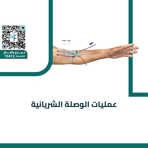 الوصلات الشريانية