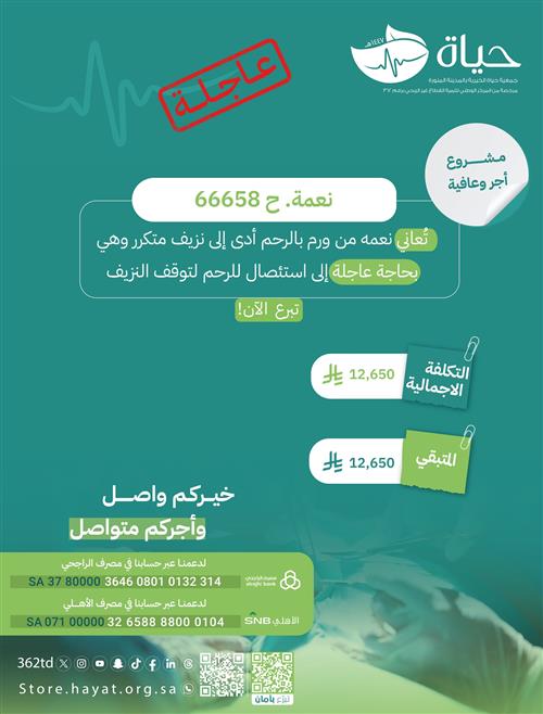 حالة نعمة. ح