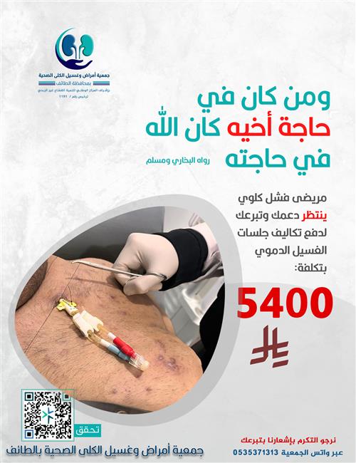 مريض فشل كلوي في حاجة لدعم جلسات غسيله الكلوي