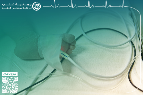 طفلة تعاني من ضعف عضلة قلبها