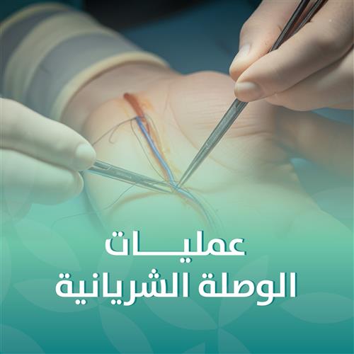 عمليات الوصلة الوريدية الشريانية