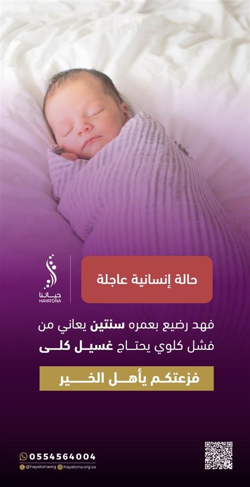 حالة إنسانية عاجلة لطفل رضيع يعاني من فشل كلوي