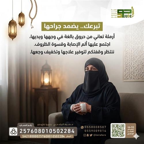 ارمله اصبتها حروق 