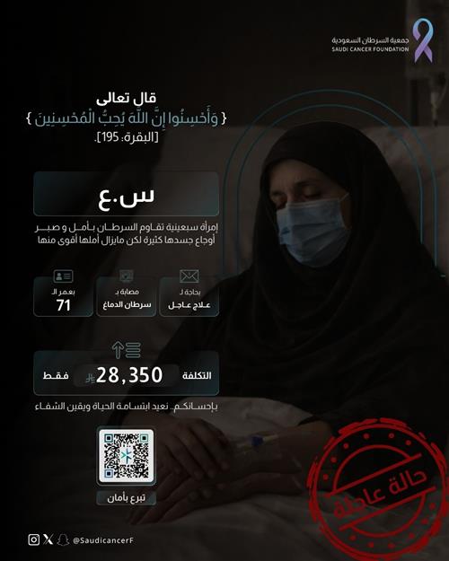 الحاله 2026871
