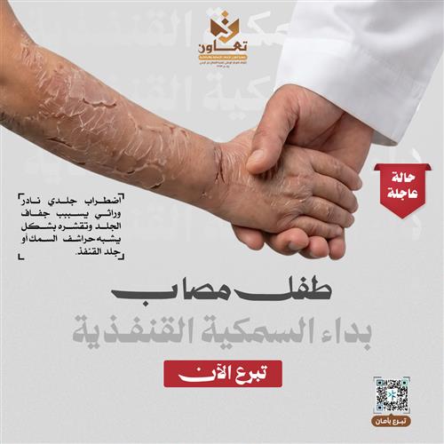 طفل يصارع داء السمكية القنفذية 