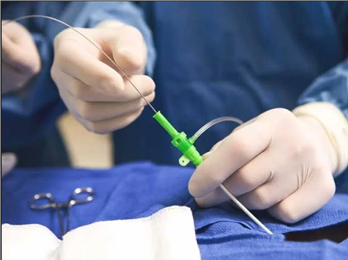 ام ايتام بحاجة الى عملية استئصال مرارة بشكل عاجل 