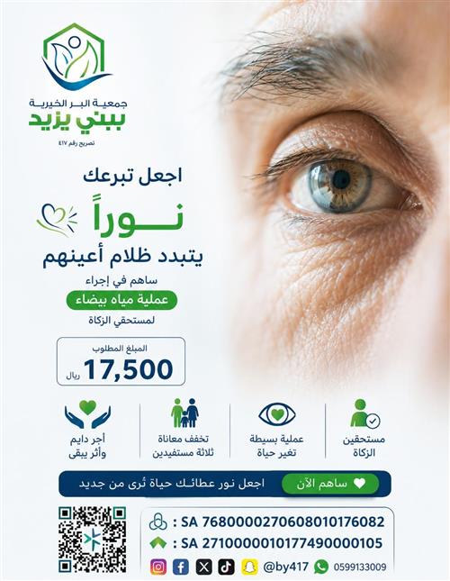 حالة عاجلة ( لثلاثة مستفيدين يعانون من الماء الابيض بالعين)