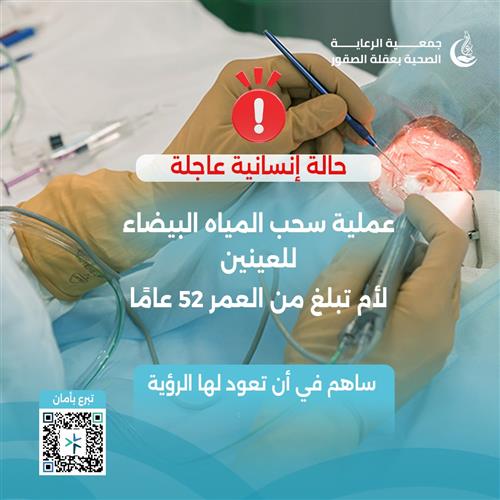 عملية سحب المياه البيضاء من العينين لأم بعمر 52 عاماً