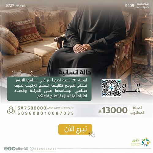 ارملة تحتاج الى تركيب طرف صناعي