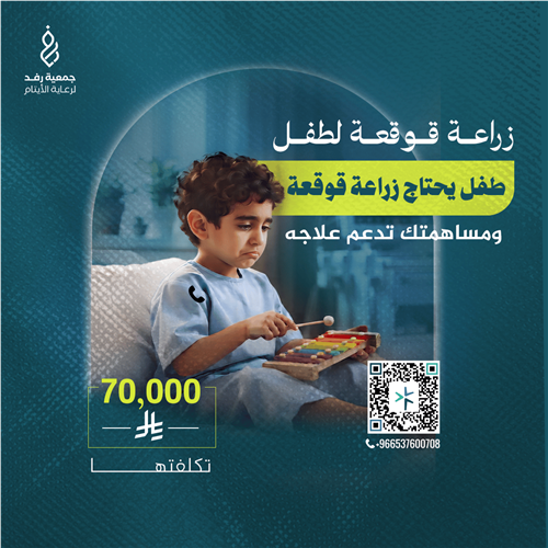 مساهمتك قد تكون سبب لإكمال مبلغ عملية زراعة قوقعة لطفل يتيم